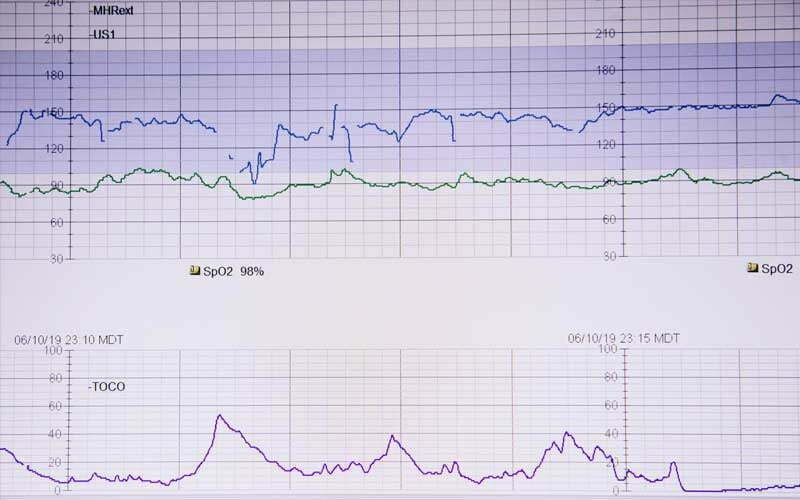 Bild zeigt Herzrate auf einem EKG
