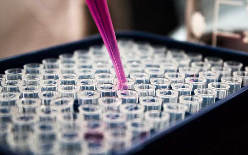 Bild zeigt Reagenzgläser und Pipette